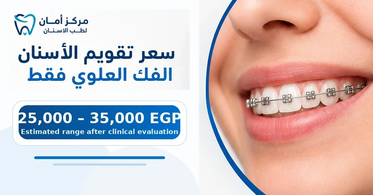 سعر تقويم الأسنان الفك العلوي فقط: دليلك الشامل للتكلفة والعوامل المؤثرة