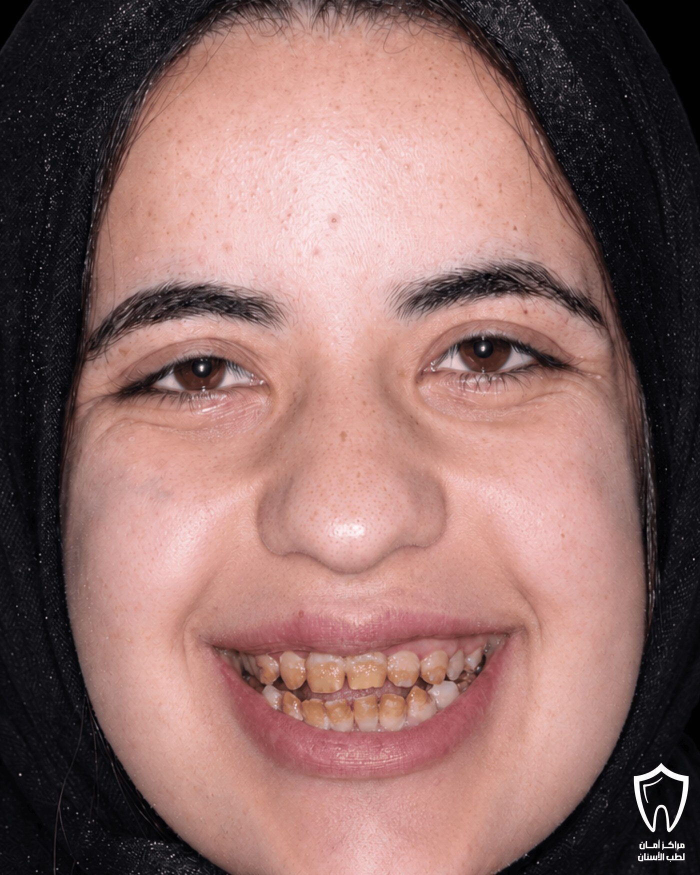 حالاتنا قبل وبعد — قبل