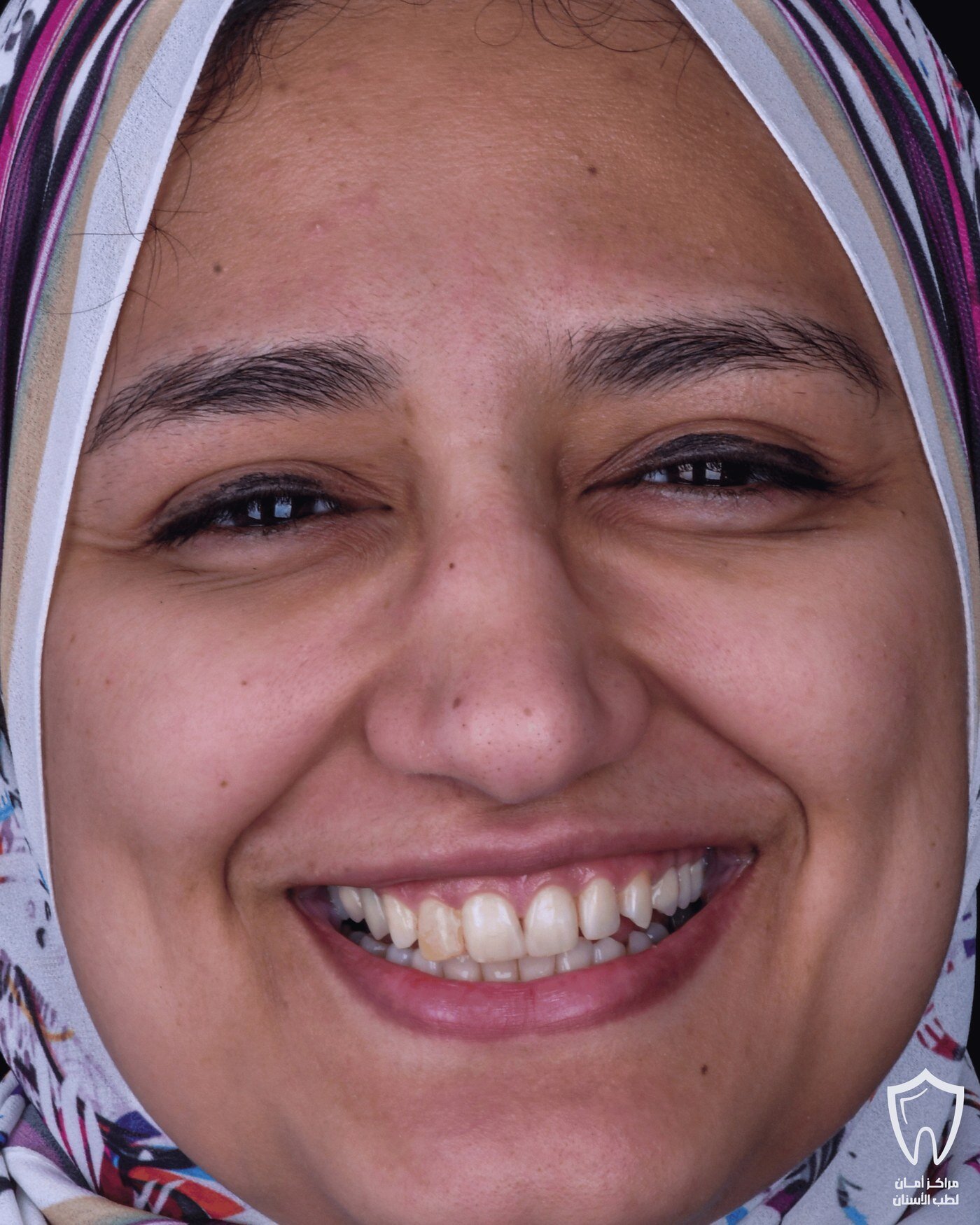 حالاتنا قبل وبعد — قبل