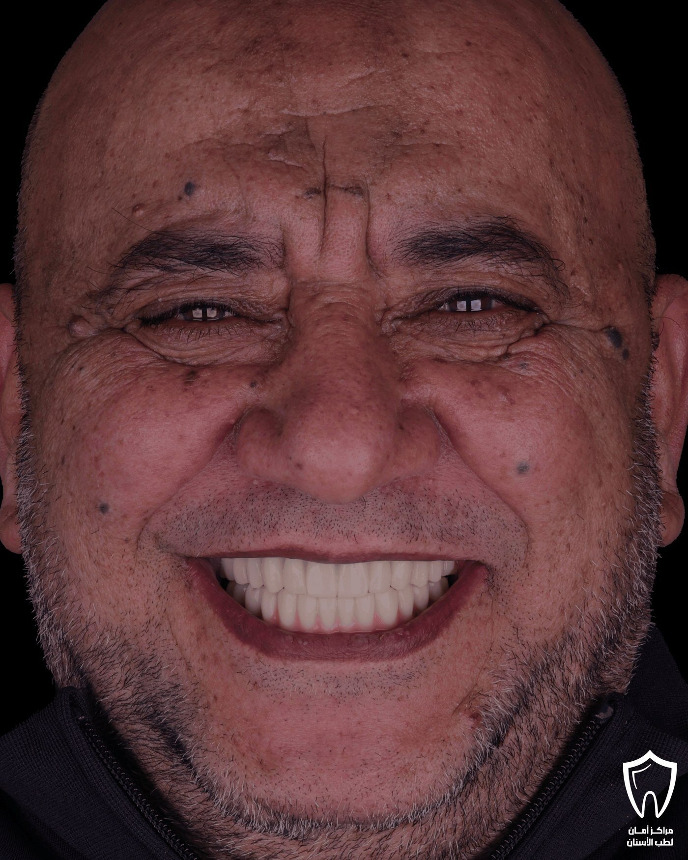 حالاتنا قبل وبعد — بعد