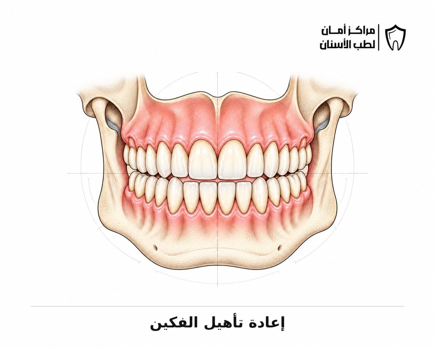 إعادة تأهيل الفكين