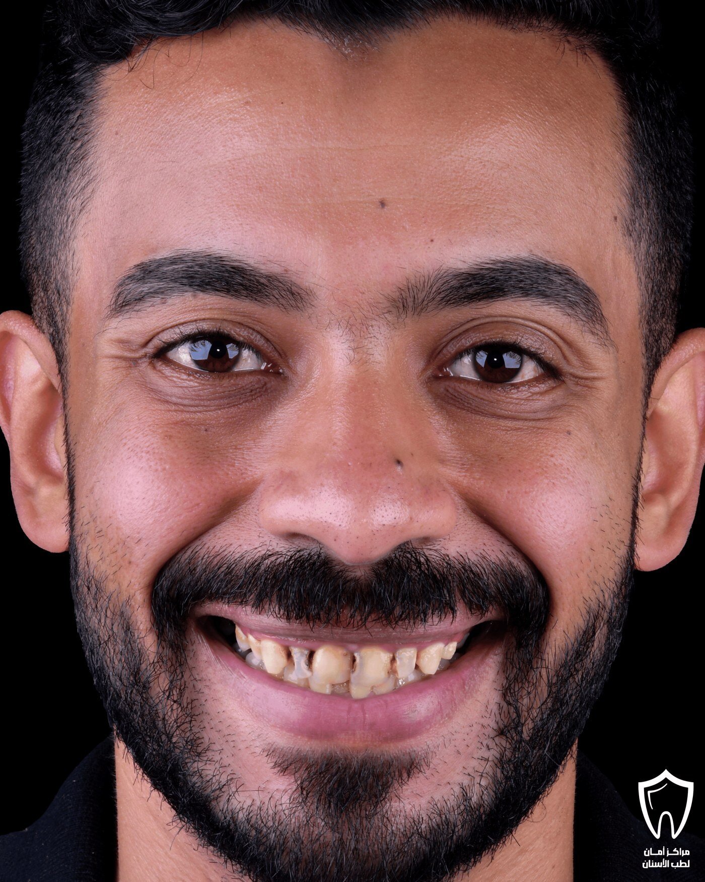 حالاتنا قبل وبعد — قبل