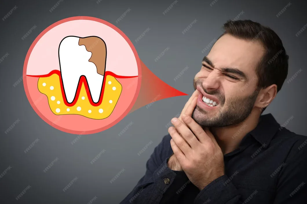 تعليمات ما بعد زراعة الاسنان|مركز امان