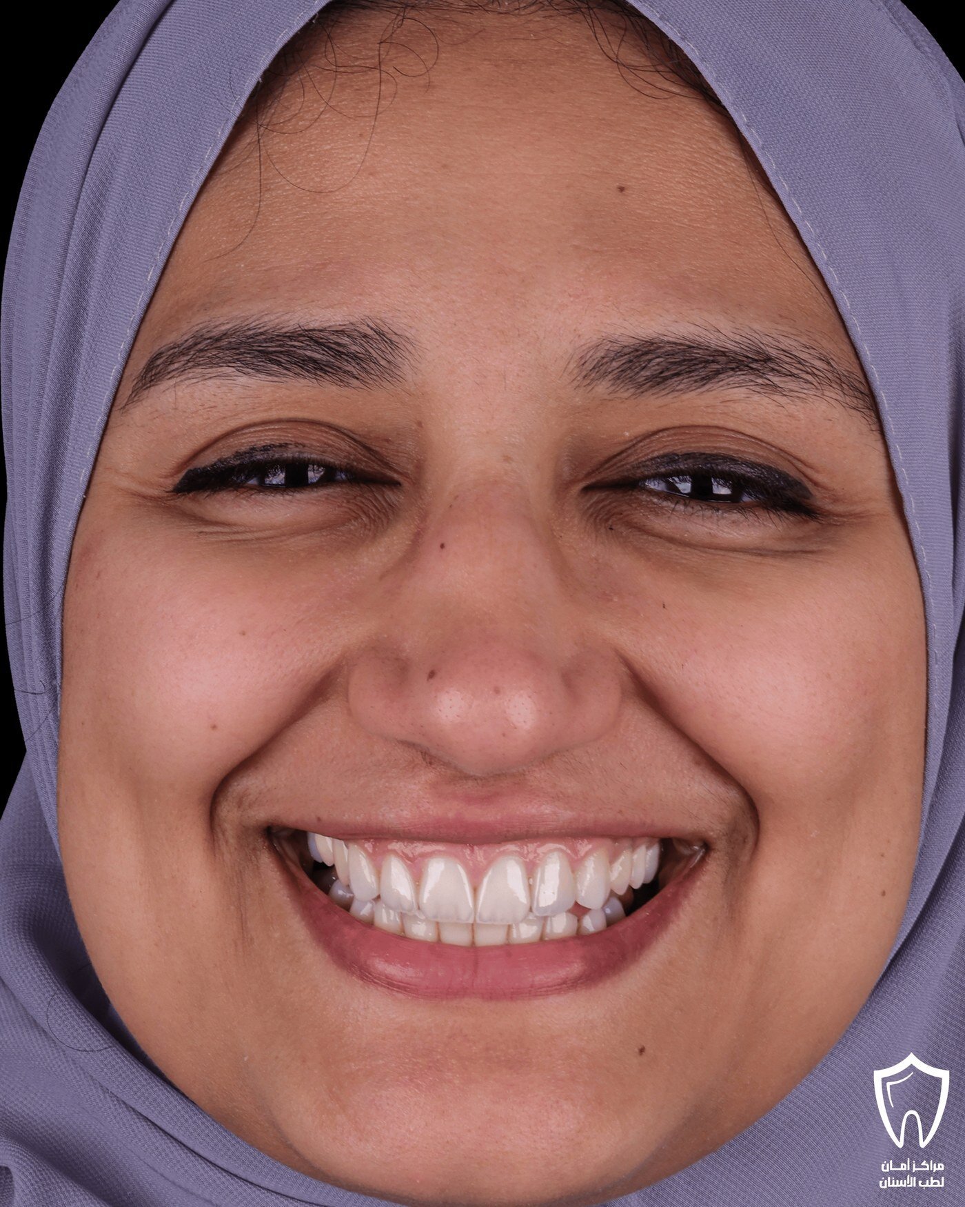 حالاتنا قبل وبعد — بعد