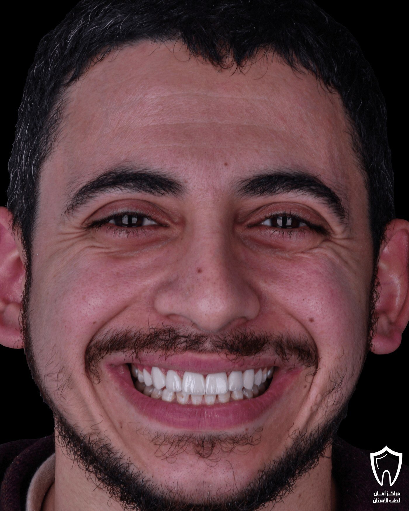 حالاتنا قبل وبعد — بعد