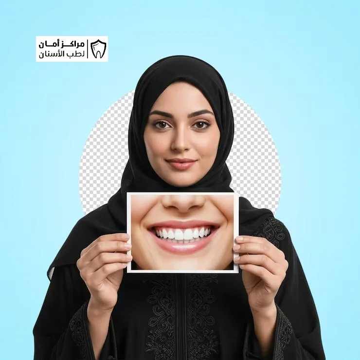 هل نتائج تجميل الاسنان دائمة؟