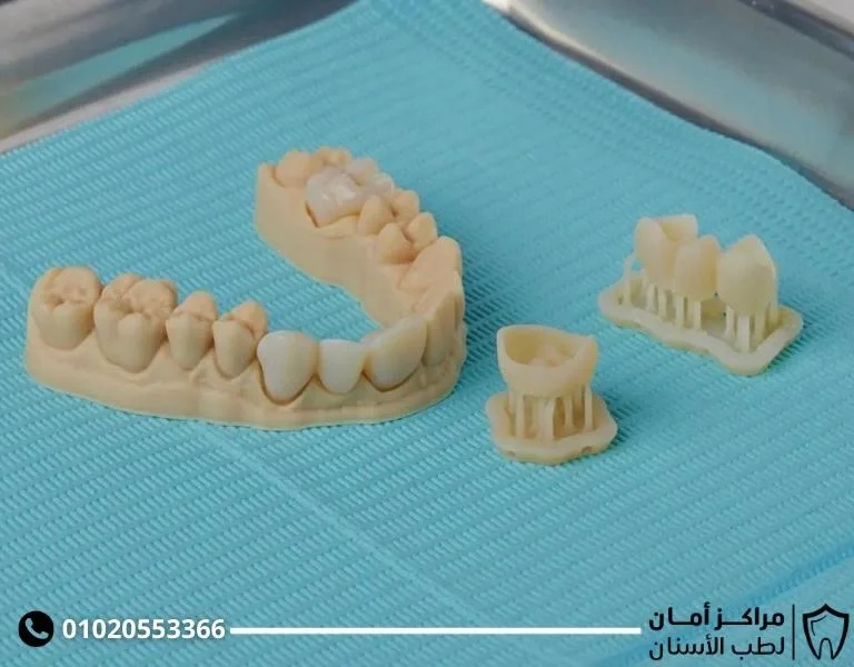 انواع جير الاسنان: الدليل الشامل للأسباب والعلاج والوقاية