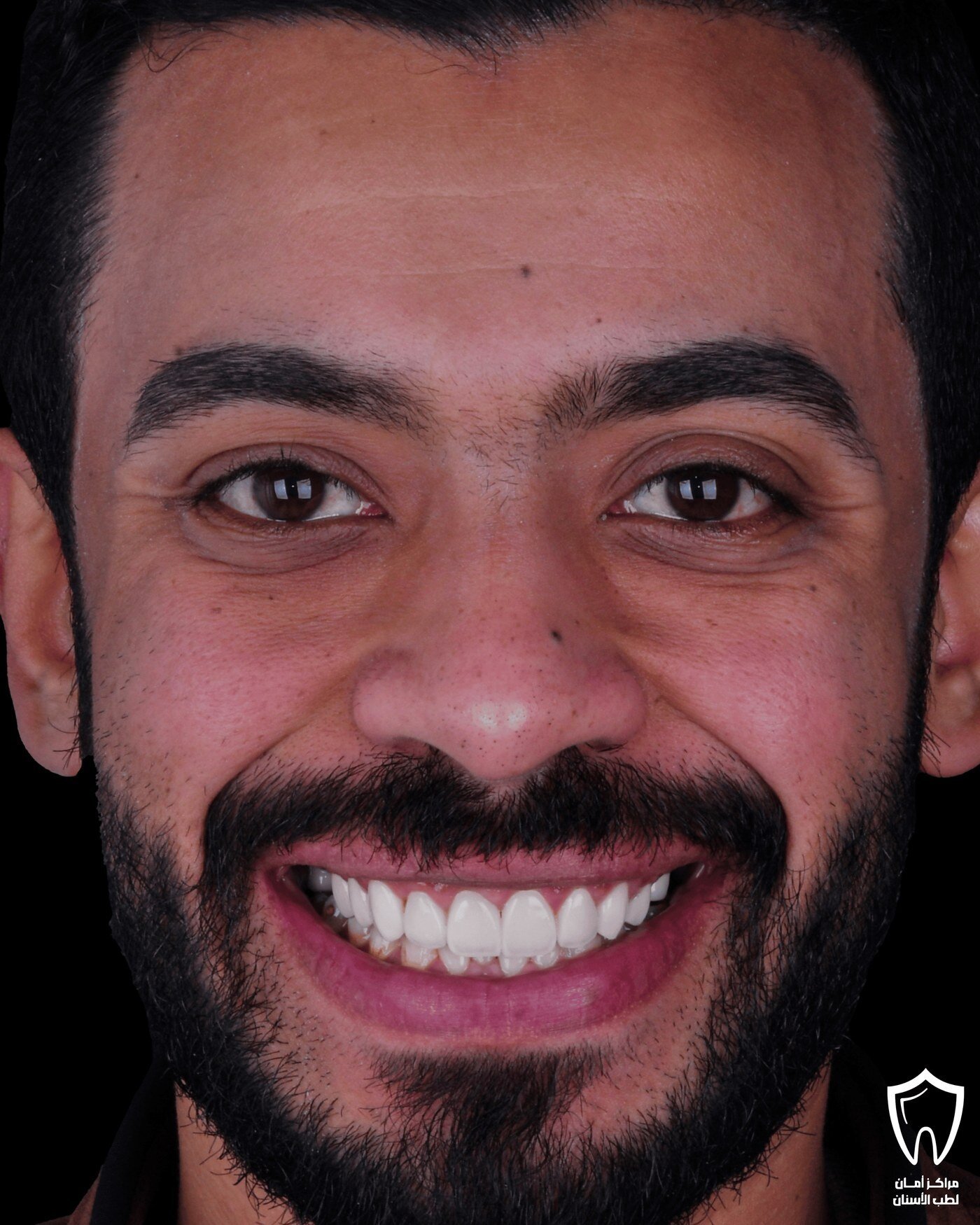 حالاتنا قبل وبعد — بعد