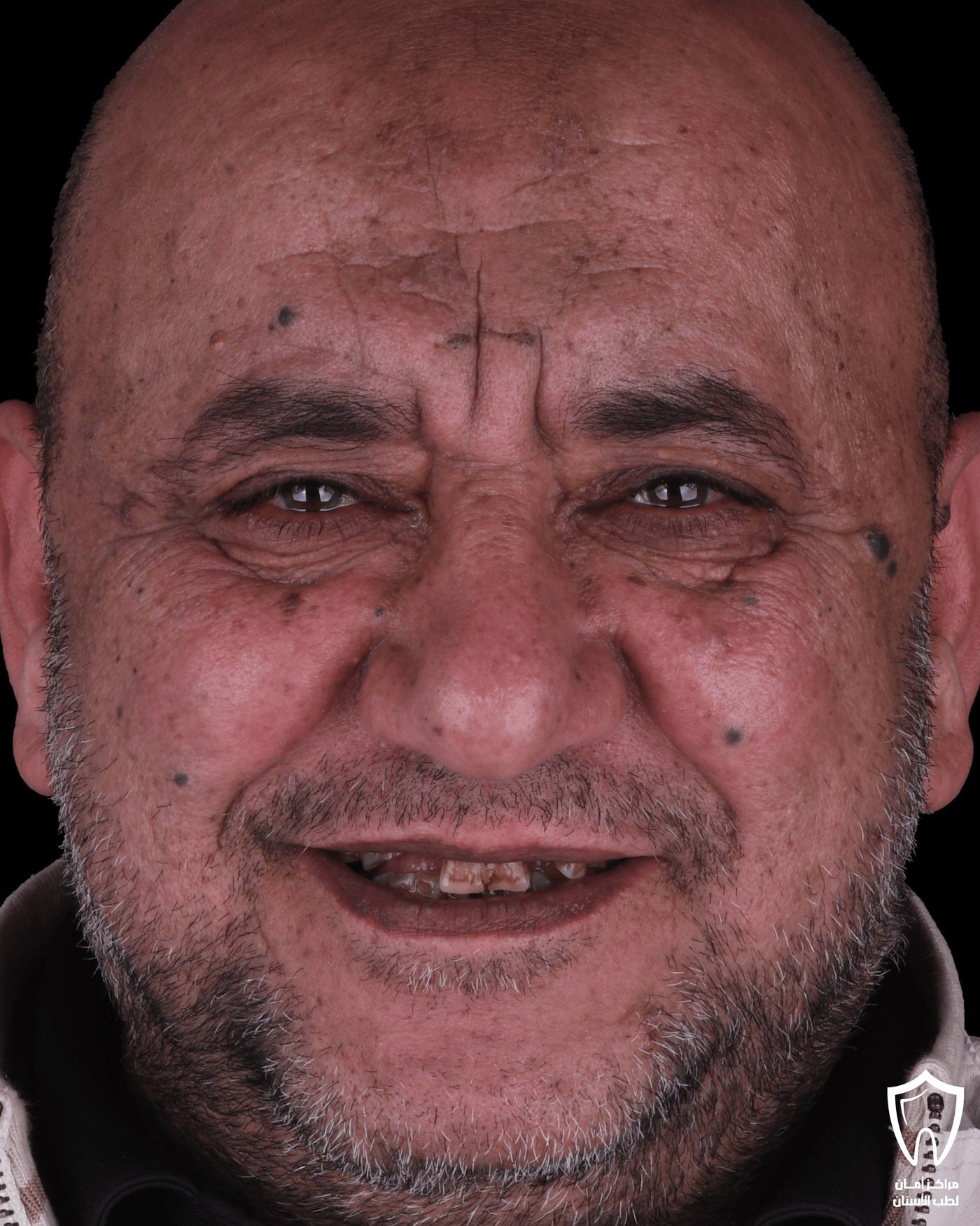حالاتنا قبل وبعد — قبل