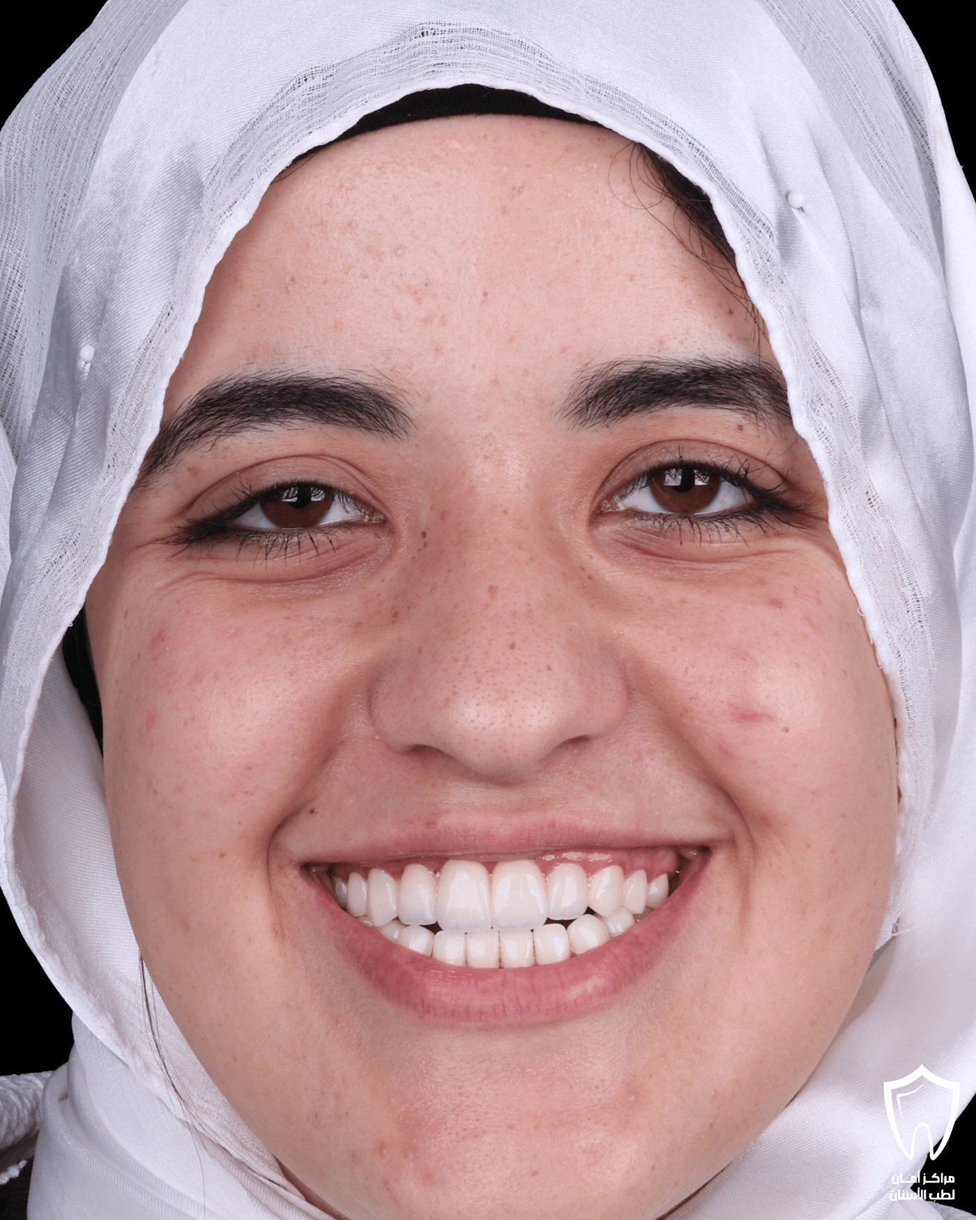 حالاتنا قبل وبعد — بعد
