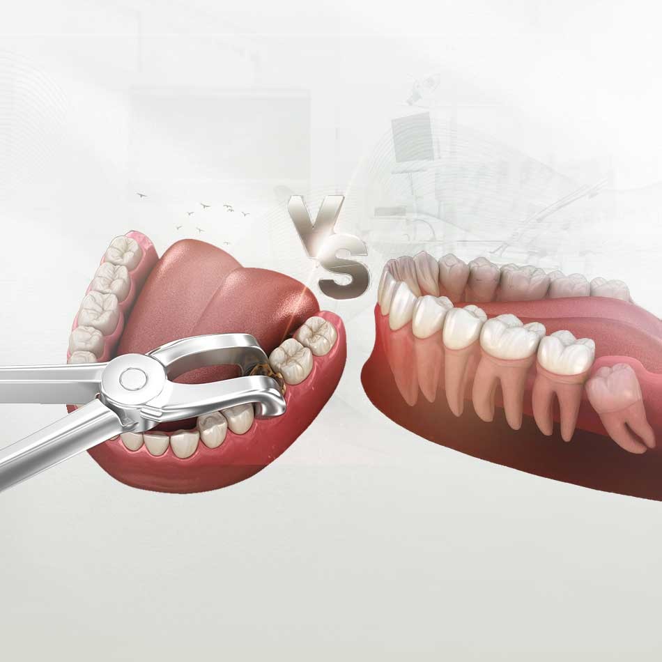 الخلع والخلع الجراحي