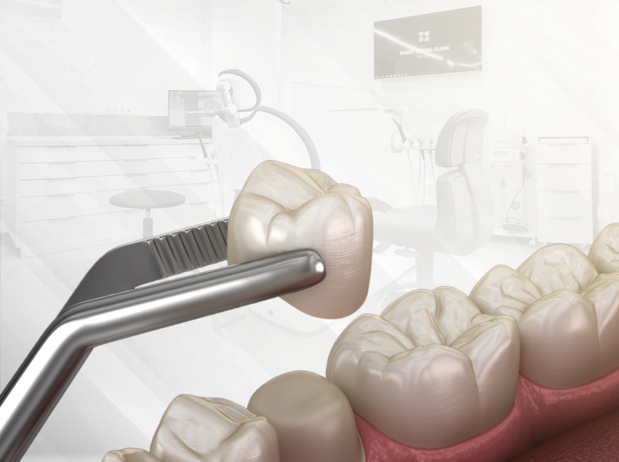 تركيبات الاسنان