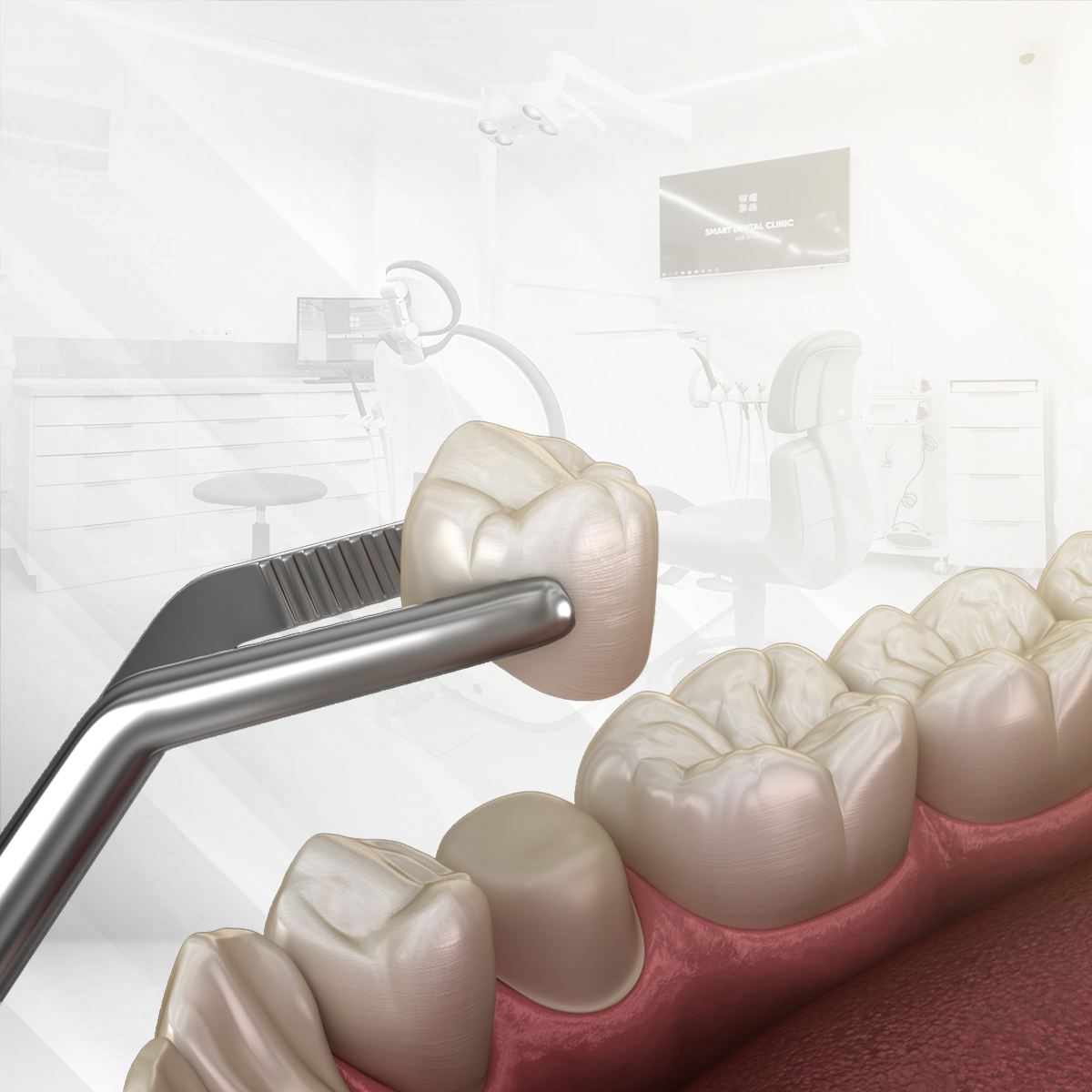 التركيبات الاسنان