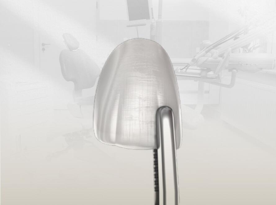 فينير الاسنان