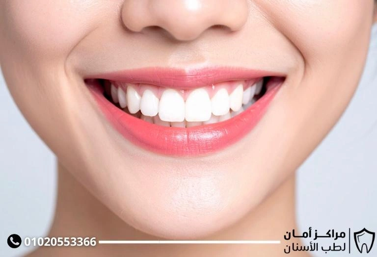 مدة تقويم الاسنان البارزة