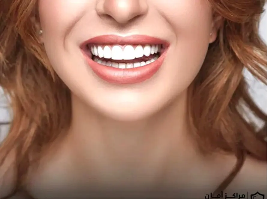 علاج التهاب اللثة سريع المفعول