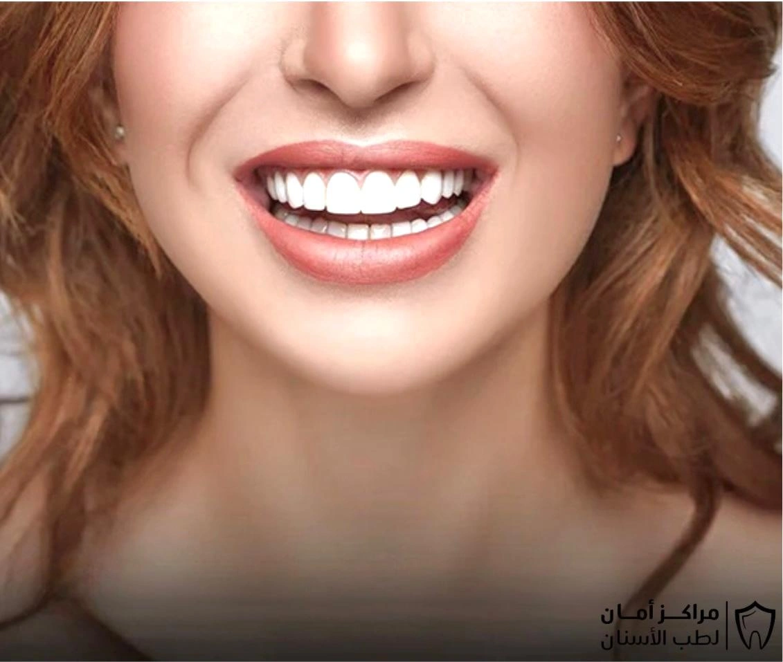 علاج التهاب اللثة سريع المفعول