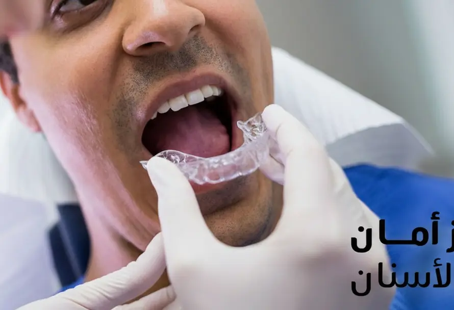 أسعار تقويم الأسنان بالليزر في مصر