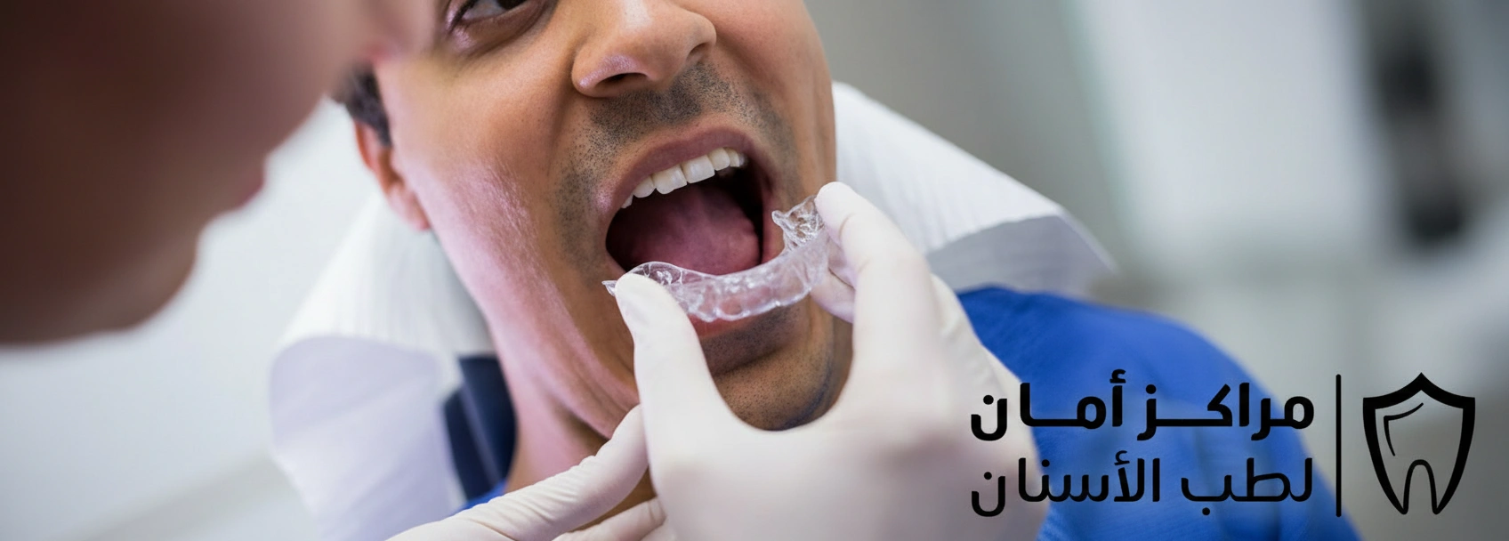 أسعار تقويم الأسنان بالليزر في مصر