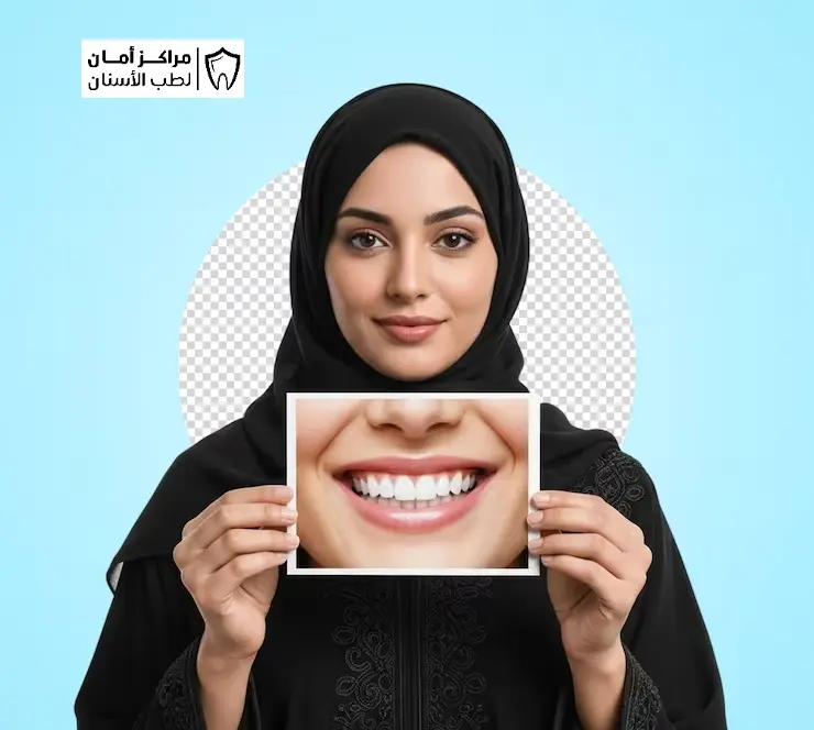 هل نتائج تجميل الاسنان دائمة