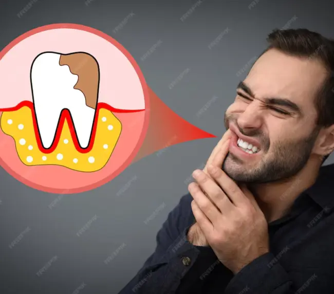 تعليمات ما بعد زراعة الاسنان