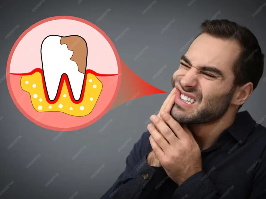تعليمات ما بعد زراعة الاسنان