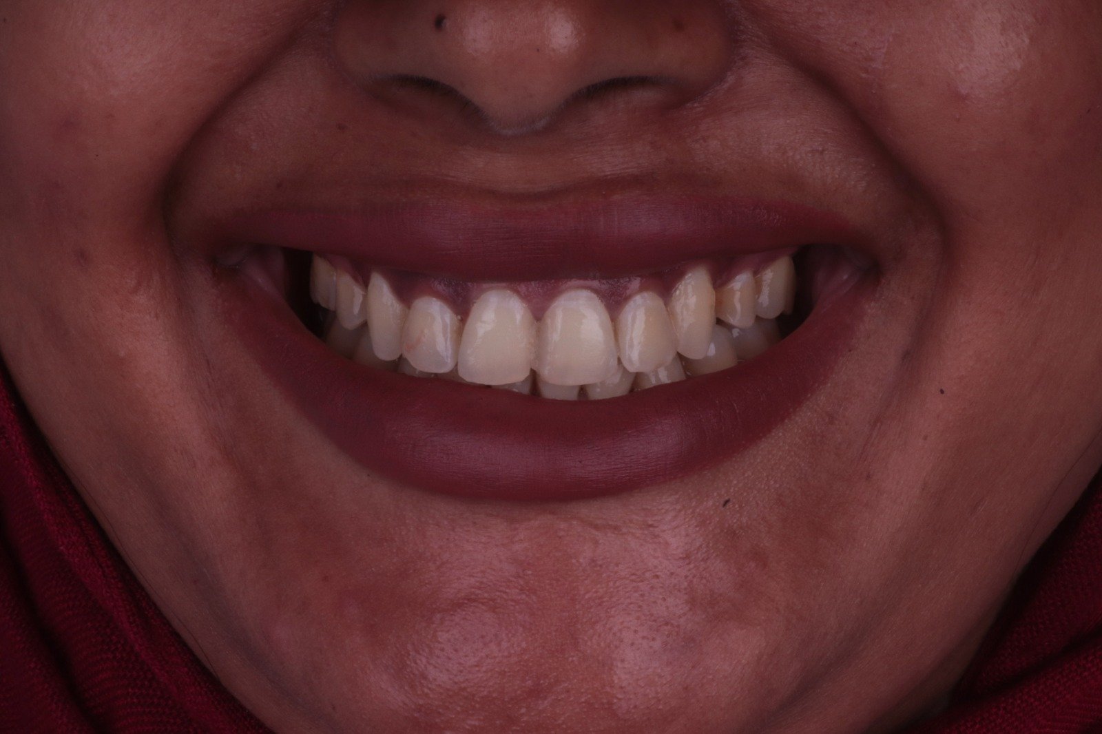 Before