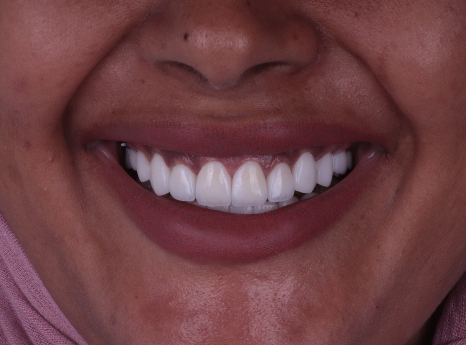 After