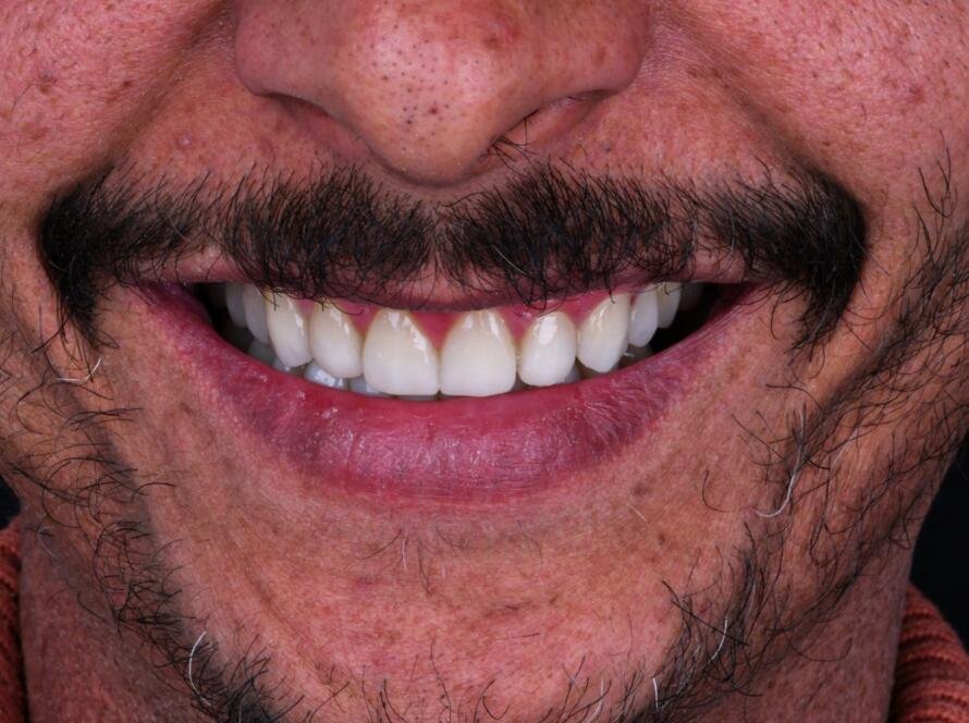 Photograph of a smile