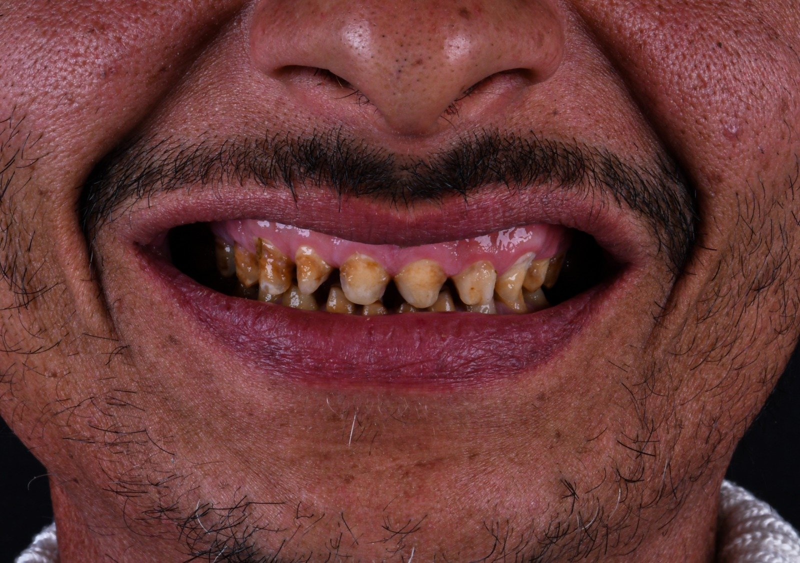 Before