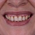 Bad breath: causes, daily care and when to see a dentist