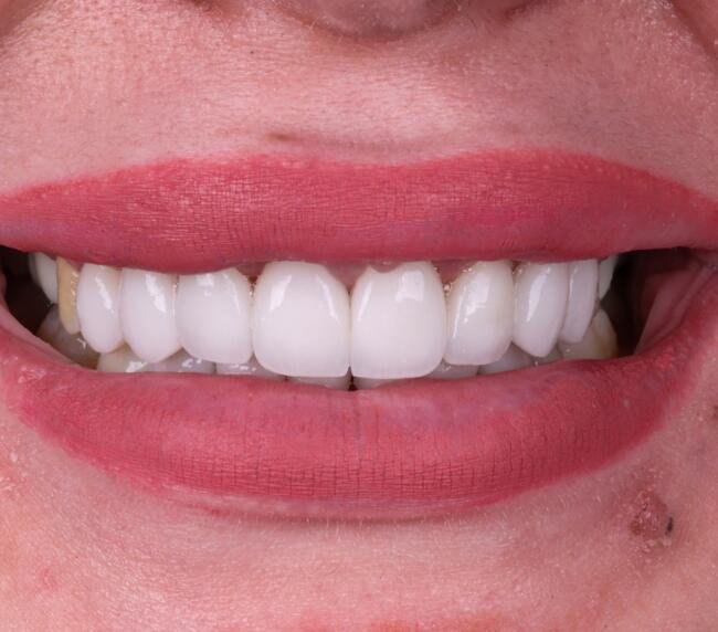 Photograph of teeth and gums